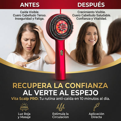 Cepillo Masajeador Capilar - Vita Scalp PRO™